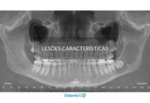 Tratamento de Lesões Características lesoes caracteristicas
