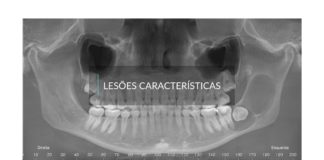 Tratamento de Lesões Características lesoes caracteristicas