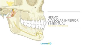 Nervo Alveolar Inferior e Nervo Mentual – Resumo de Técnicas Anestésicas