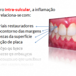 inter4