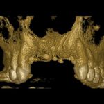 3d bones