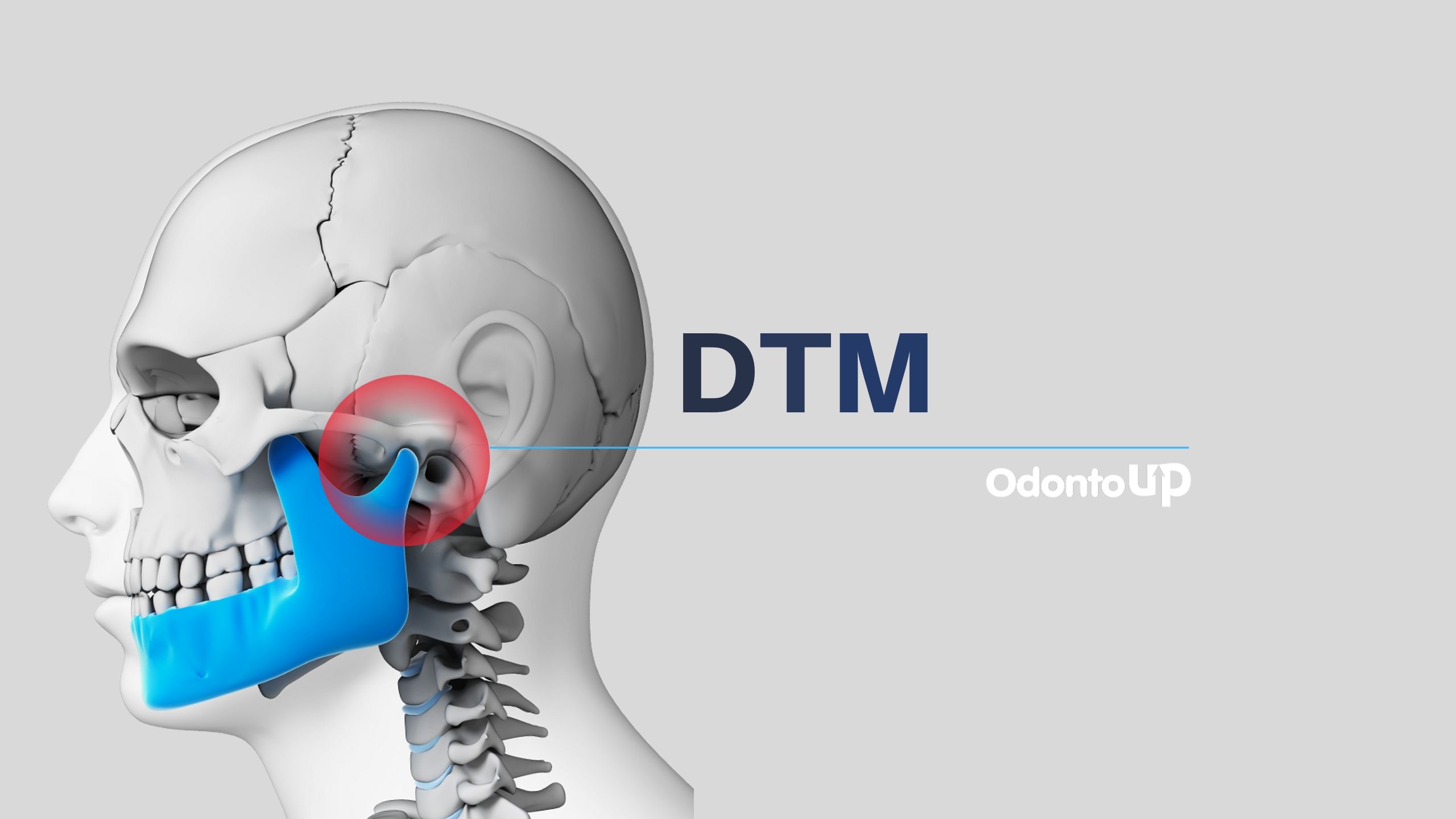 O que é DTM?