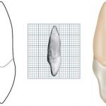ICS DISTAL