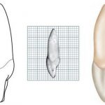 ICS MESIAL