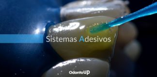 Sistemas Adesivos Convencionais x Sistemas Adesivos Autocondicionantes