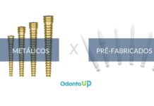 Pinos Metálicos X Pinos de Fibra Pré-Fabricados