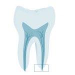 dente7