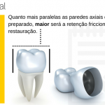 retenção friccional