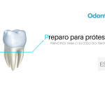 Preparo para prótese fixa