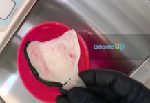 Delimitação da Área Basal