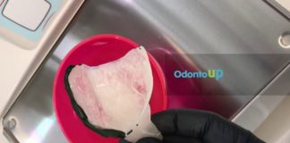 Delimitação da Área Basal