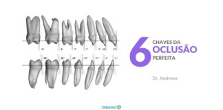 As 6 Chaves da Oclusão Perfeita de Andrews