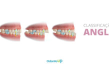 Classificação de Angle