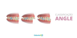 Classificação de Angle