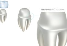 Tipos de Términos em Prótese Fixa