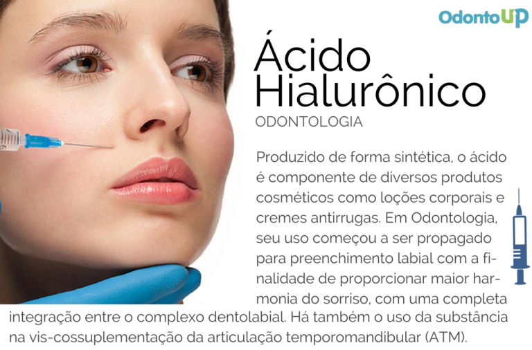 Preenchimento Com Ácido Hialurônico No Dentista Top 5 Dúvidas - Mobile