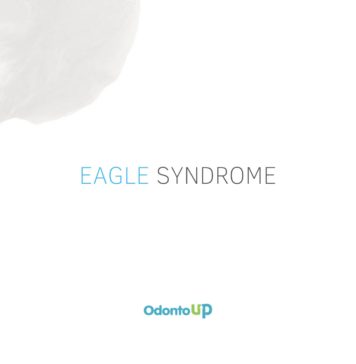 Síndrome de Eagle