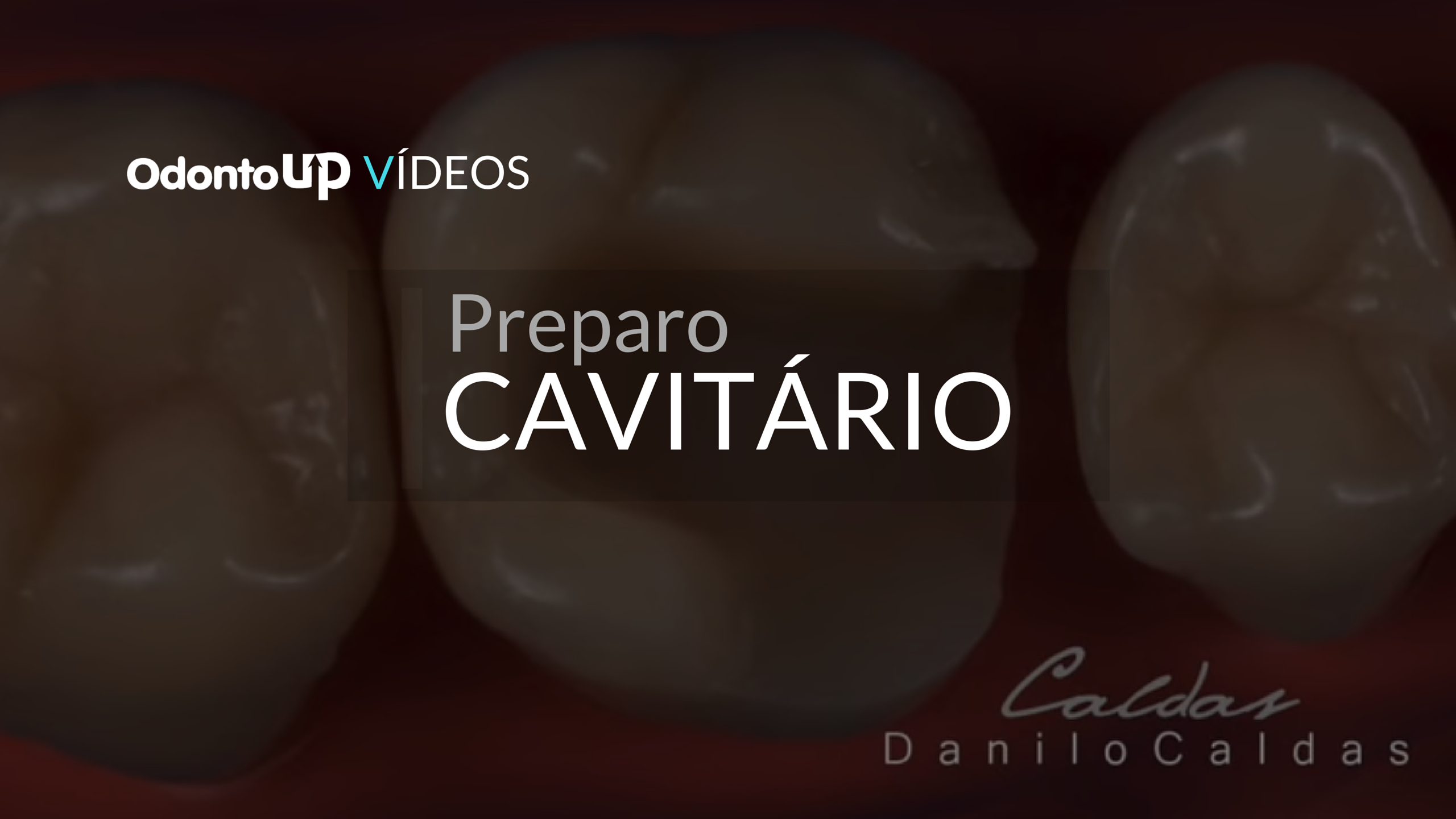 Preparo Cavitário