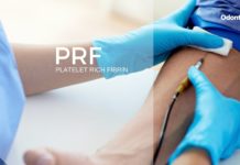 PRF: Fibrina Rica em Plaquetas