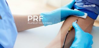 PRF: Fibrina Rica em Plaquetas