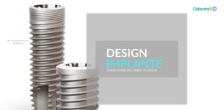 Design dos Implantes: Uma Terminologia Geral