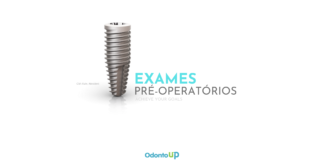 Exames Pré-Operatórios no Tratamento com Implantes