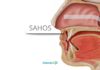 Síndrome de Apneia e Hipopneia Obstrutiva do Sono (SAHOS)