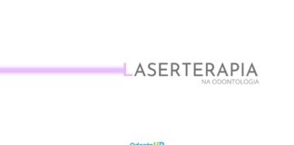 Laserterapia – Aplicações na Odontologia