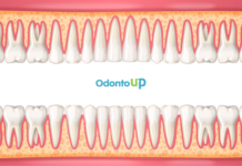 Tipos de dentes humanos: incisivos, caninos, pré-molares e molares tipos de dentes humanos – classificação na Odontologia